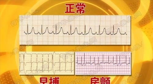 心慌吃点什么药效果好