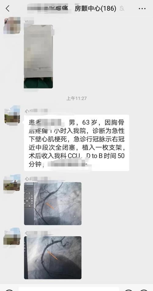 心脏造影有死亡风险吗