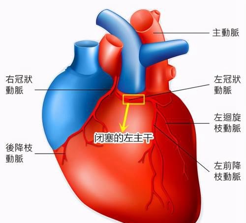 心脏的三根大血管,堵塞后会有什么后果