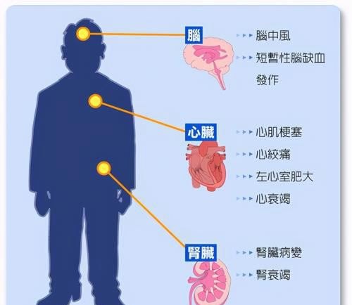 高血压200昏迷不醒