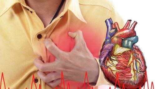 心肌缺血的五种类型