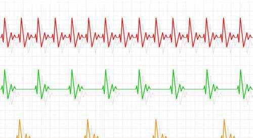 心脏电击除颤的电压是多少伏