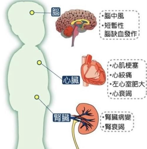 血压12080是什么意思