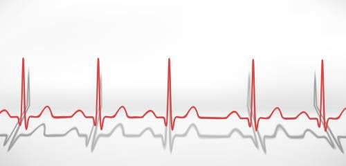 冠脉ct能检查出什么心肌缺血冯?