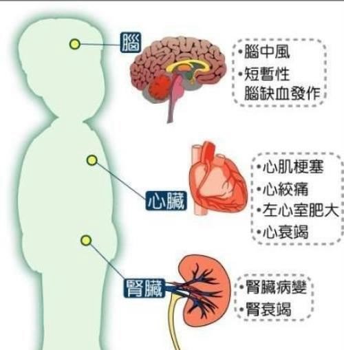 中国人为什么血压高