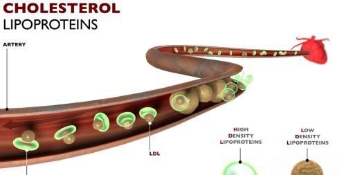 胆固醇对血管的作用