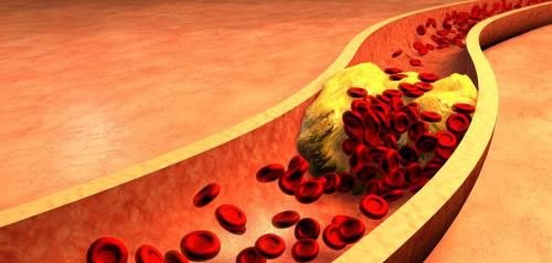 胆固醇对血管的作用