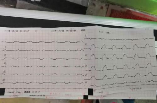 后背疼问医生