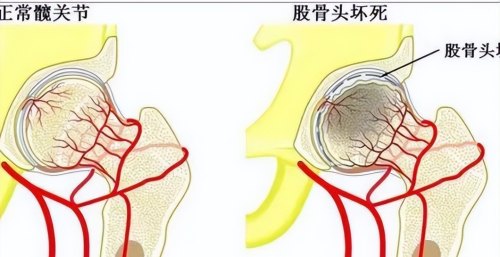 骨科病怎么治