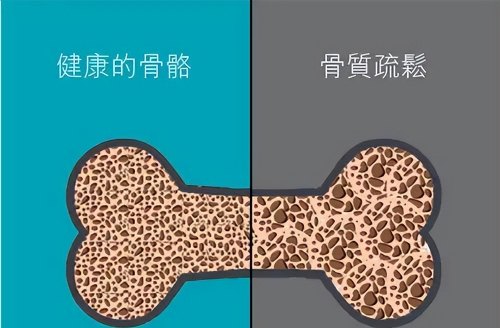 46-55岁是生命高危期