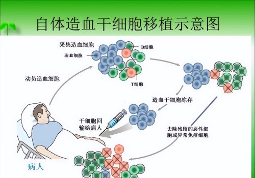 现在孩子得白血病越来越多,是何原因呢