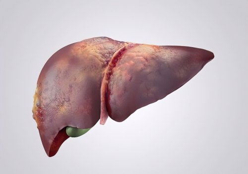 每年新增肝癌患者高达41万?出现这4种现象是什么