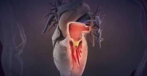 心梗喉咙症状有哪些