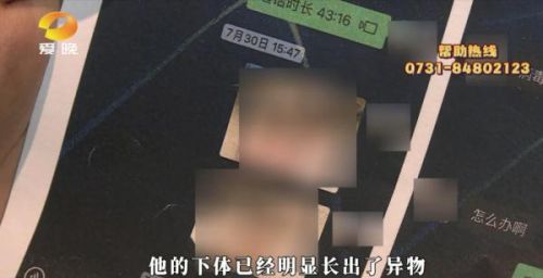 女生称被男友传染疾病后遭抛弃：承诺好好生活他却离开了