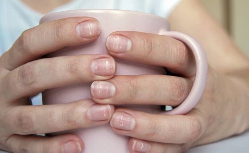 指甲若长成3个样子，或是癌或疾病的信号，需要引起重视