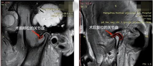 整张脸变歪！18岁漂亮姑娘突然嘴都张不开，问题出在这