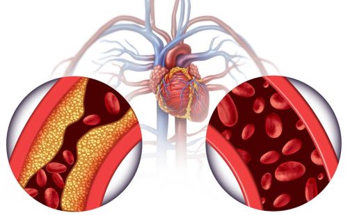又腥又臭？日科学家发现“血管清理剂”，BMJ：心血管风险降低24%