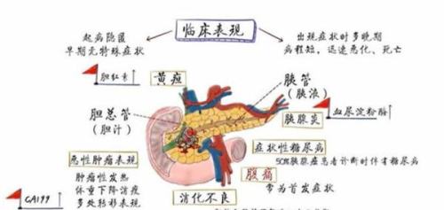 为什么胰腺癌被称为“癌中之王”，出现这些症状要当心