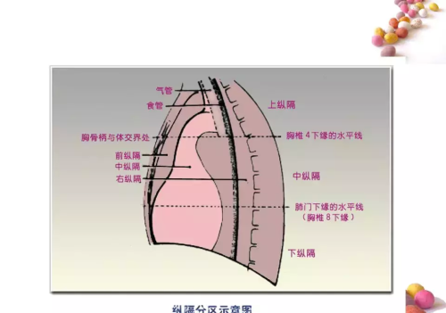 正常x片胸片(正常胸片x光片图及讲解)