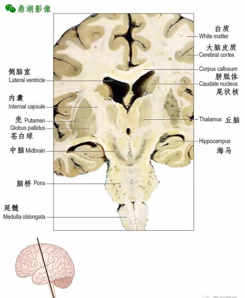 中枢神经系统脑的组成(中枢神经系统 | 脑干的内部结构)