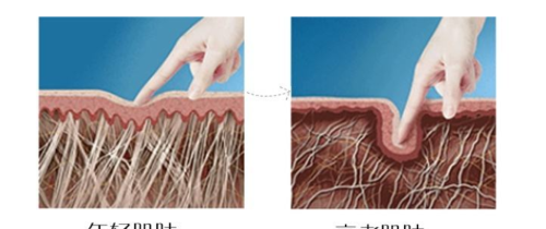 如何加速真皮层的恢复(真皮层的好处)