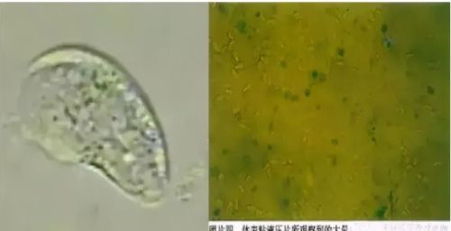 23种养鱼常见的寄生虫图鉴大全(23种养鱼常见的寄生虫图鉴图片)