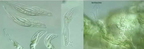 23种养鱼常见的寄生虫图鉴大全(23种养鱼常见的寄生虫图鉴图片)