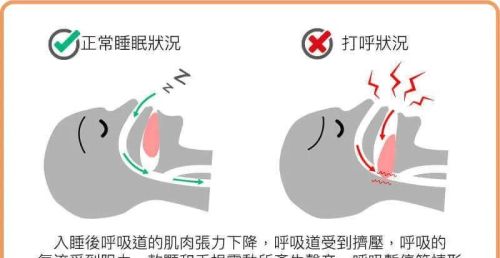 睡觉打呼是哪些因素引起的(睡觉打呼是哪些因素引起的原因)