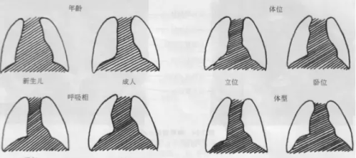 手把手教你读懂胸部x线(胸部x线结果解读)