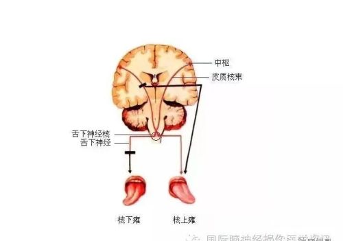 十二对颅神经解剖及损伤后表现有哪些(十二对颅神经解剖位置)