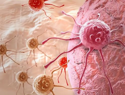 人体都有癌细胞为何不患癌