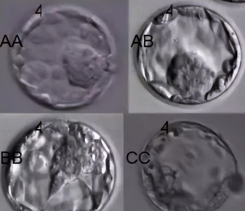 囊胚4bb、4ab、4cb是什么级别?有什么区别？