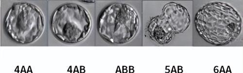 囊胚4bb、4ab、4cb是什么级别?有什么区别？