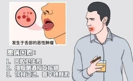 舌癌要如何预防？