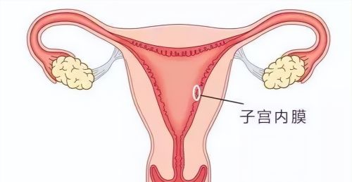 子宫内膜癌并非毫无征兆，身体出现3个表现，说明子宫已经受损了