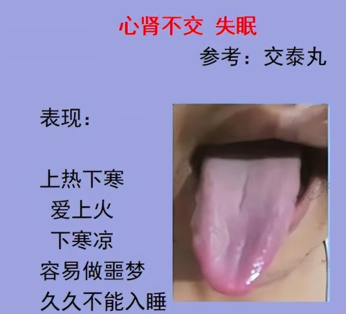 失眠怎么办好呢，看看中医怎么说