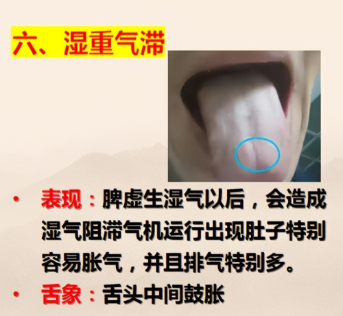 脾胃虚？十四个阶段你了解吗，来看看你是第几阶段