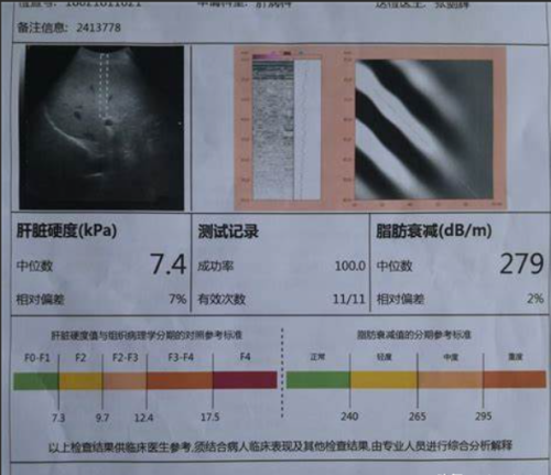 医生张仲景的经典名方剂，养肝护肝，肝硬化的患者快收藏