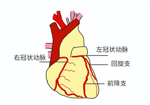 男子胸闷误以为新冠后遗症，医生：再晚来一步，神仙都难保……