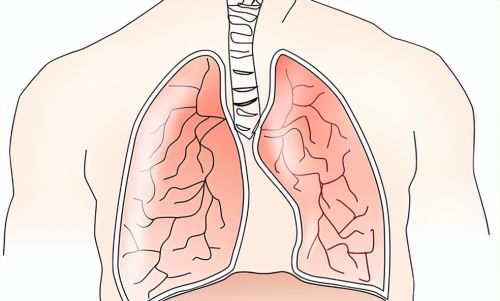 国人发病率、致死率最高的肿瘤均是肺癌，这3种食物，有助预防
