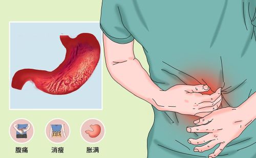 胃炎是阴虚、失眠是阴虚、口干还是阴虚，3药帮你摆脱阴虚火旺