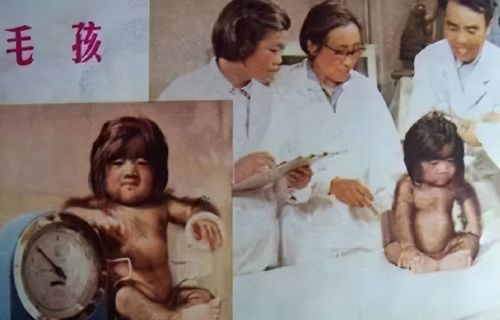 中国第一毛孩：出生就被研究，因“一身毛”爆火，如今现状如何？