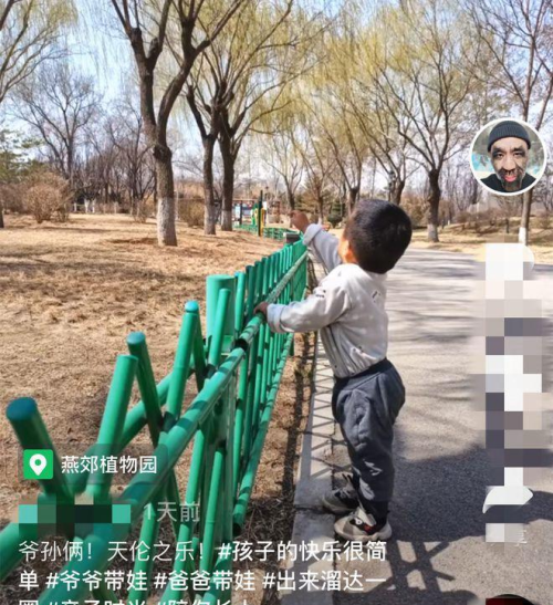 中国第一毛孩：出生就被研究，因“一身毛”爆火，如今现状如何？
