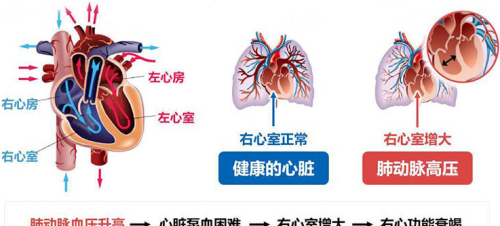 为什么中国要禁用死囚器官？禁止后，全国器官依然严重短缺