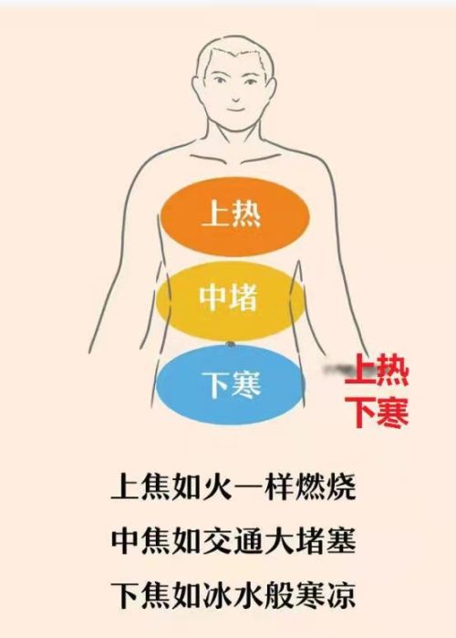 脚凉，还爱上火，说一个方子思路，可以使身体“受热均匀”