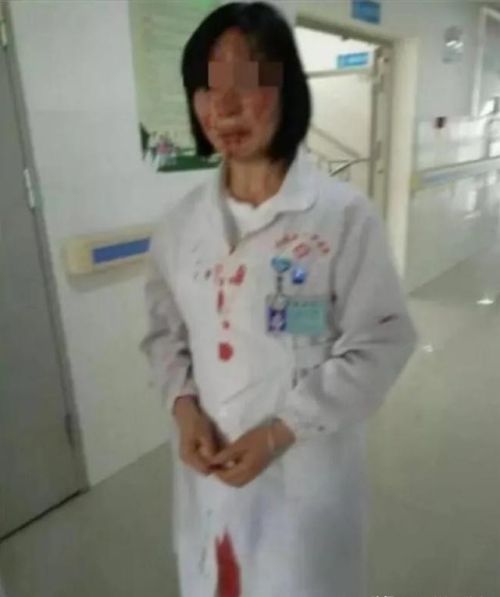 太让人气愤！护士脸上被患儿家属连扎20针！