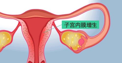 关于子宫癌你知道多少，老公的大姨一确诊就是晚期了