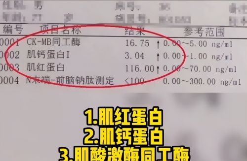 心脏好不好，化验3个指标能看出来！3类心肌标志物是哪些？