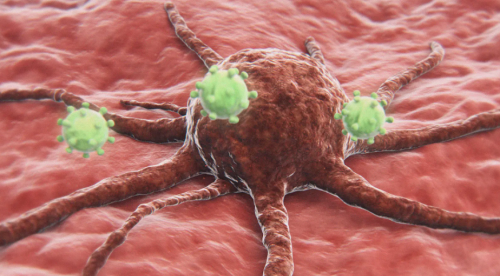 饿死癌细胞，被证实有效！损伤小恢复快，多种癌症可用