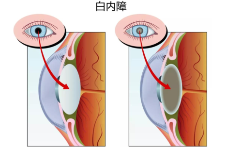 听一句劝：7种你认为的“病”，其实只是人老了！别再花钱过度治